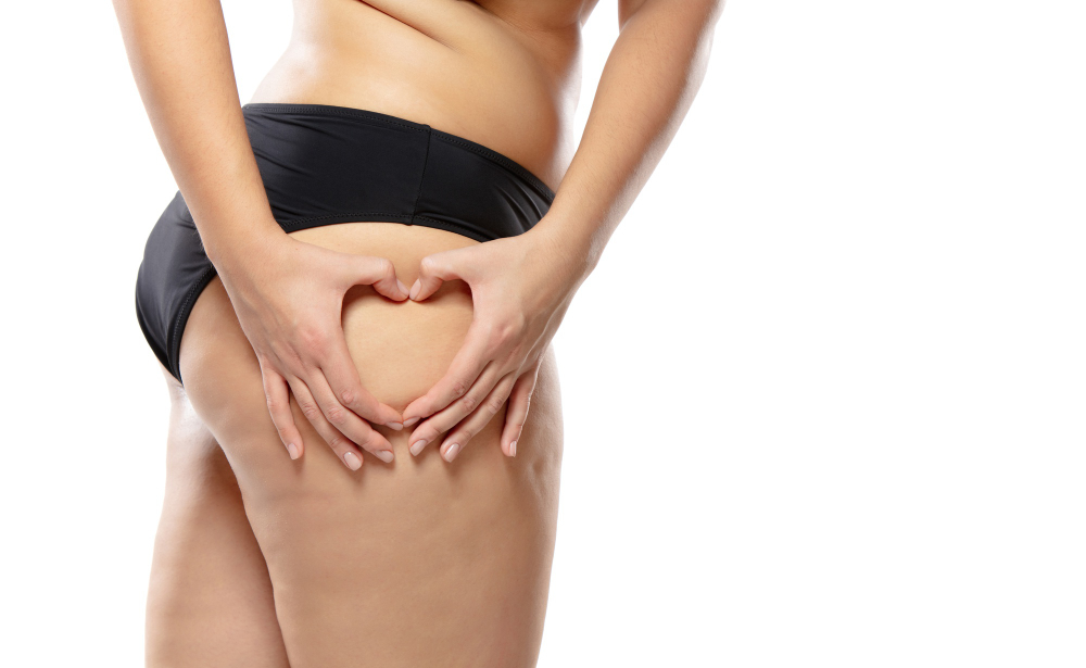 mujer-celulitis-ropa-interior-negra